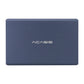 Acasis EC-7252 2.5" Hard Drive Case 2 Bay HDD Enclosure w/ 4 RAID Modes for 12TB &amp; 2.5" SATA HHD SSD