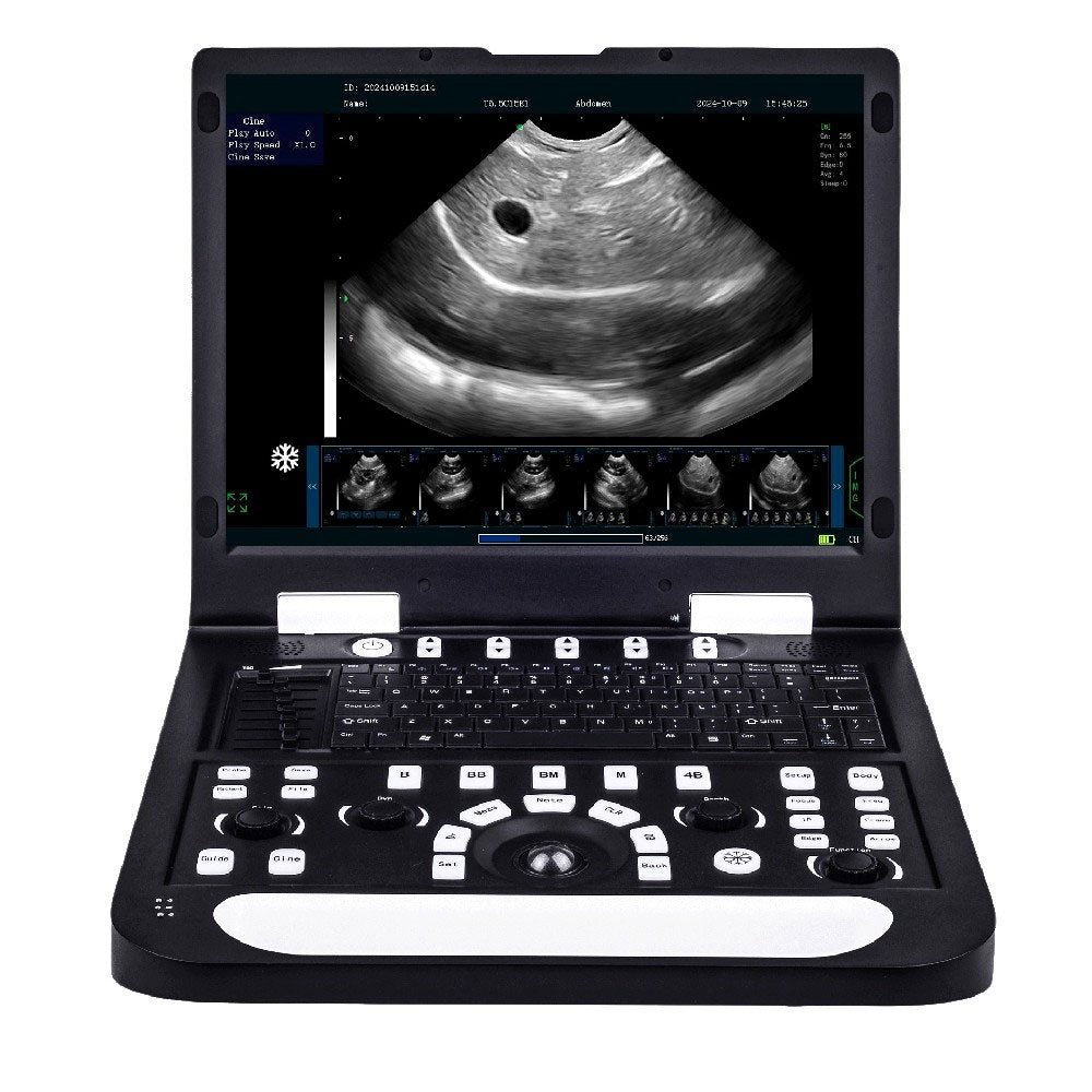 RS-N60 Full Digital PC Processing System Veterinary Ultrasonic Diagnostic Instrument 128G SSD 15-inch LCD