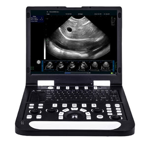 RS-N60 Full Digital PC Processing System Veterinary Ultrasonic Diagnostic Instrument 128G SSD 15-inch LCD