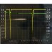 UPSDZ Lithium Battery Capacity Tester Meter Power Supply Aging Detection Discharger Electronic Load