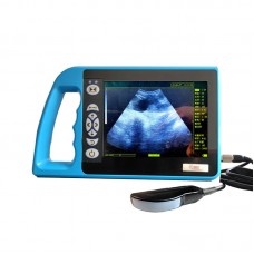 BTS-N40 Portable Bovine B-Ultrasound Machine with 8-inch Display Screen and 128 Array Element Rectal Probe