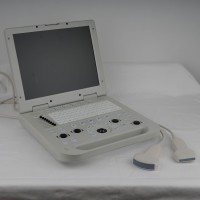 N20 Portable Full Digital Laptop Ultrasound Diagnostic System Dual Probe Port with 15-inch HD Display